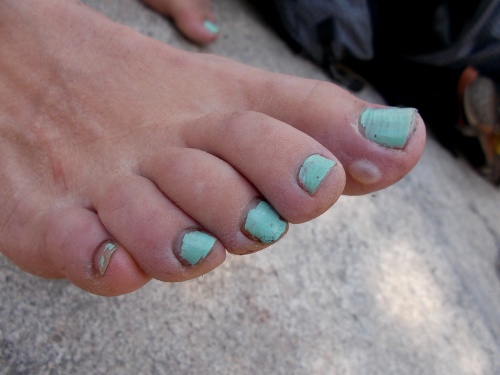 Blister!